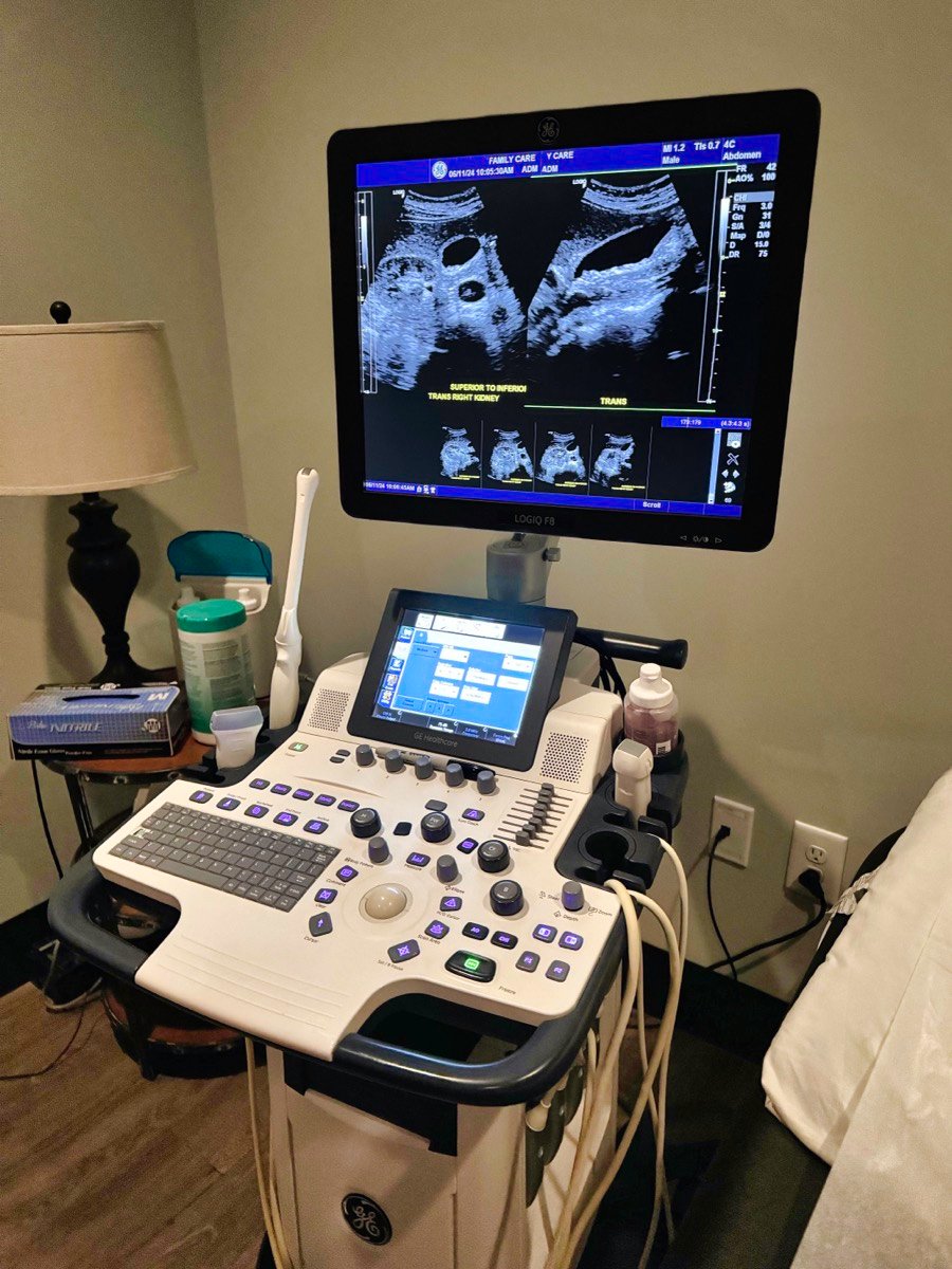 Portable ultrasound system